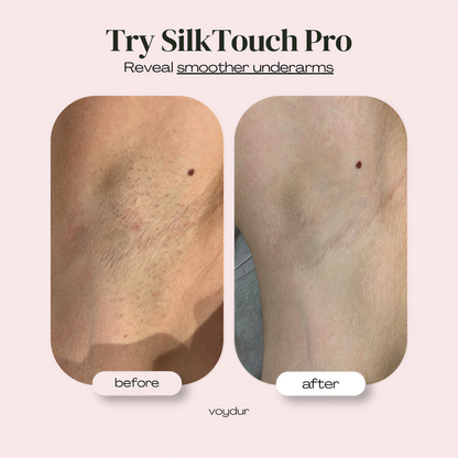 SilkTouch Pro™